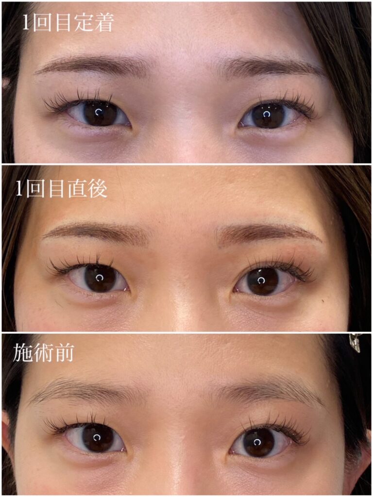 アートメイクナースライカ・眉写真